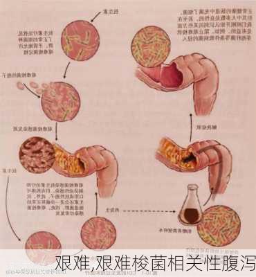 艰难,艰难梭菌相关性腹泻-第3张图片-星梦范文网